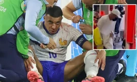 Mbappe gãy mũi, nguy cơ lỡ đại chiến với tuyển Hà Lan