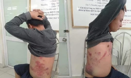 Ông Hà Văn Nam từng cho rằng, bản thân bị đánh vào ngày 28/1 vì phản đối trạm BOT thu phí sai.