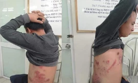 Ông Hà Văn Nam từng cho rằng, bản thân bị đánh vào ngày 28/1 vì phản đối trạm BOT thu phí sai.