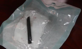 Ẩu đả với bạn, chiếc đũa 'mắc kẹt' trong hốc mắt người đàn ông suốt 4 năm