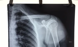 Xô xát với người lạ, nam thanh niên bị phóng dao thấu vai