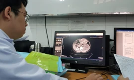 Đi khám vì bụng chướng, bệnh nhân tá hỏa khi bác sĩ ‘lôi ra’ 3 khối u