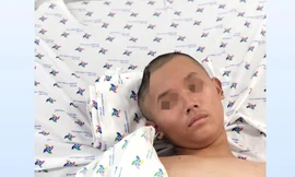 Ngỡ sốt đau đầu thông thường, bé trai hôn mê do phù não