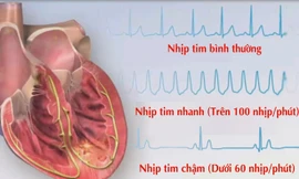 Bé gái mắc bệnh hiếm khiến tim đập nhanh 200 lần/ phút
