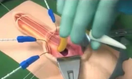 Khi 'cậu nhỏ' được điều khiển theo ý muốn nhờ... công tắc