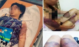 Bố cô gái bị giam giữ, tra tấn suốt 21 ngày: 'Tôi đau như chết đi sống lại'