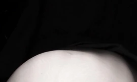 Nữ bệnh nhân mang khối u khủng nặng 8kg 