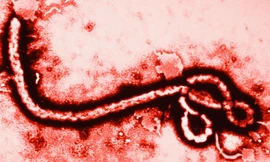 [ĐỒ HỌA] Báo động đỏ toàn cầu đại dịch Ebola