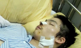 Chém chủ quán để 'bùng' tiền hát karaoke