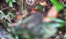 Nạn nhân bị trúng 13 mảnh đạn ria vào vùng tay và ngực làm thủng phổi dẫn đến tử vong. Ảnh: Q.T