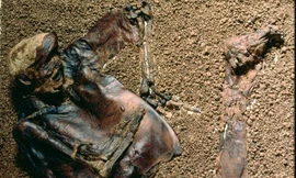 Thi thể của Lindow Man.