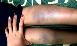 Báo động hành xử thô bạo của học sinh trong khi điểm giáo dục công dân lại cao chót vót