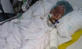 Bình gas phát nổ, gia đình 4 người cháy đen