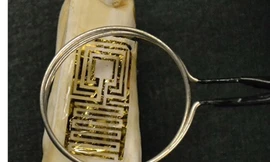 'Xăm răng' công nghệ cao để chuẩn đoán bệnh