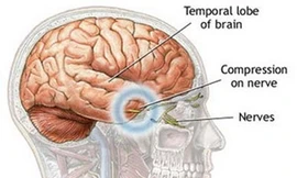 Hình ảnh não người. (Nguồn: Internet)
