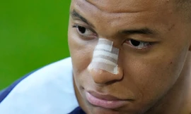Cận cảnh chiếc mũi bị gãy của Kylian Mbappe, người có thể ra sân với mặt nạ... ninja rùa
