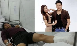 Minh Tiệp ngã ngựa ngay trước đêm diễn CĐHH