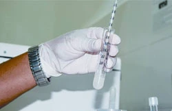 Tinh trùng cho điều trị vô sinh rất hiếm hoi. Ảnh: Thanh Tùng (Thanh Niên)