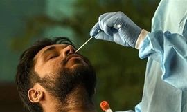 Biến thể COVID-19 mới XBB.1.16 gây ra các bệnh về mắt