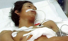 Nhậu say, múa dao tự đâm xuyên tim