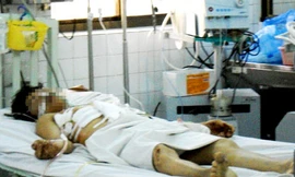 Nghi can Đ. đang được điều trị tại bệnh viện