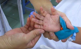 Biến đổi khí hậu làm tăng nguy cơ sốt xuất huyết, tay chân miệng