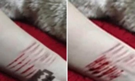 Thiếu nữ thất tình rạch tay làm ...kỷ niệm