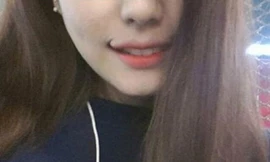 Gái Hàn quay cuồng với mốt tạo 'môi cười'