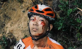 Một cua rơ dính chấn thương trên đèo Le (Quảng Nam). Ảnh: CTV