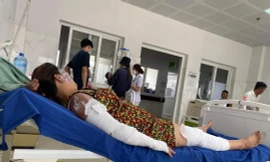 Nổ bình gas mini khi đang ăn lẩu, 7 người nhập viện