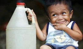 Anh chàng 18 tuổi cao… 60cm