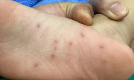 Cơ quan chức năng vào cuộc vụ trẻ em nghi bị bạo hành ở Bình Định