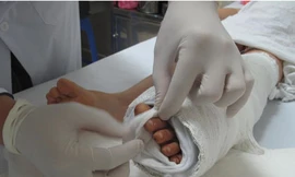 Bé gái gần đứt lìa bàn chân vì tấm chắn biển số xe