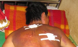 Chủ mỏ tra tấn người làm như thời trung cổ