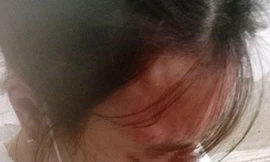 Nữ sinh lớp 10 ở Hà Tĩnh bị chủ quầy tạp hóa đánh chấn động não