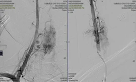 Nam thanh niên liệt suốt 13 năm sau cú ngã vì căn bệnh hiếm gặp