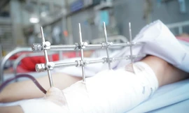 Nữ nạn nhân vụ sập tường kinh hoàng ở Long An đã thoát 'cửa tử'