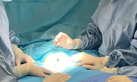 Lần đầu tiên tại Việt Nam nội soi trên xương mu can thiệp dị tật cho trẻ sơ sinh