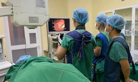 Phát hiện sán lá gan 'khủng' trong ống mật cô gái trẻ
