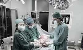 Cứu bé gái mang khối u buồng trứng khổng lồ