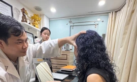 Sự thật đằng sau công nghệ căng da chỉ vàng 'trẻ ra tận 10 tuổi' 