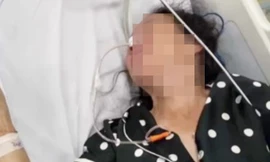 Người phụ nữ mắc bệnh cực hiếm bị nhầm với loạn thần vì tự la hét, cười nói một mình