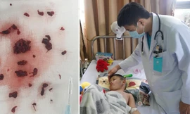 Bé trai 4 tuổi bị đột quỵ sau khi mắc COVID-19