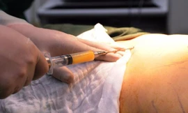 Nữ bệnh nhân ở TPHCM tử vong sau khi hút mỡ bụng làm đẹp