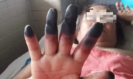 Đau nhức chân tay coi chừng bệnh lý nguy hiểm