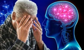 2.800 tỷ USD 'bốc hơi' theo bệnh sa sút trí tuệ