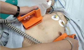 Hơn 30 lần sốc điện cứu bệnh nhân thoát khỏi 'cơn bão điện học'