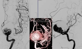 Người phụ nữ mang 'bom nổ chậm' nhập viện