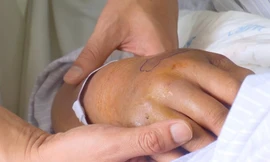 Bị rắn độc tấn công, bệnh nhi nguy kịch vì đắp thuốc thầy lang