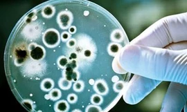 Nhiễm loại vi khuẩn kháng thuốc 'khét tiếng', nữ sinh béo phì suýt tử vong